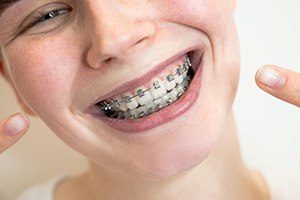 Smiling young woman pointing at her braces