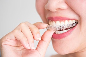Close-up of woman putting Invisalign on her teeth
