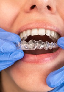 Woman getting Invisalign