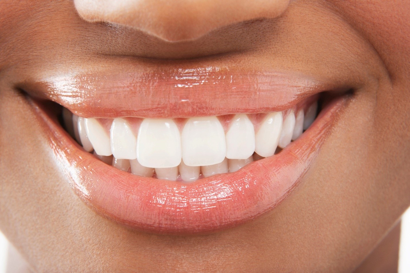 Close up of Human Teeth Shutterstock